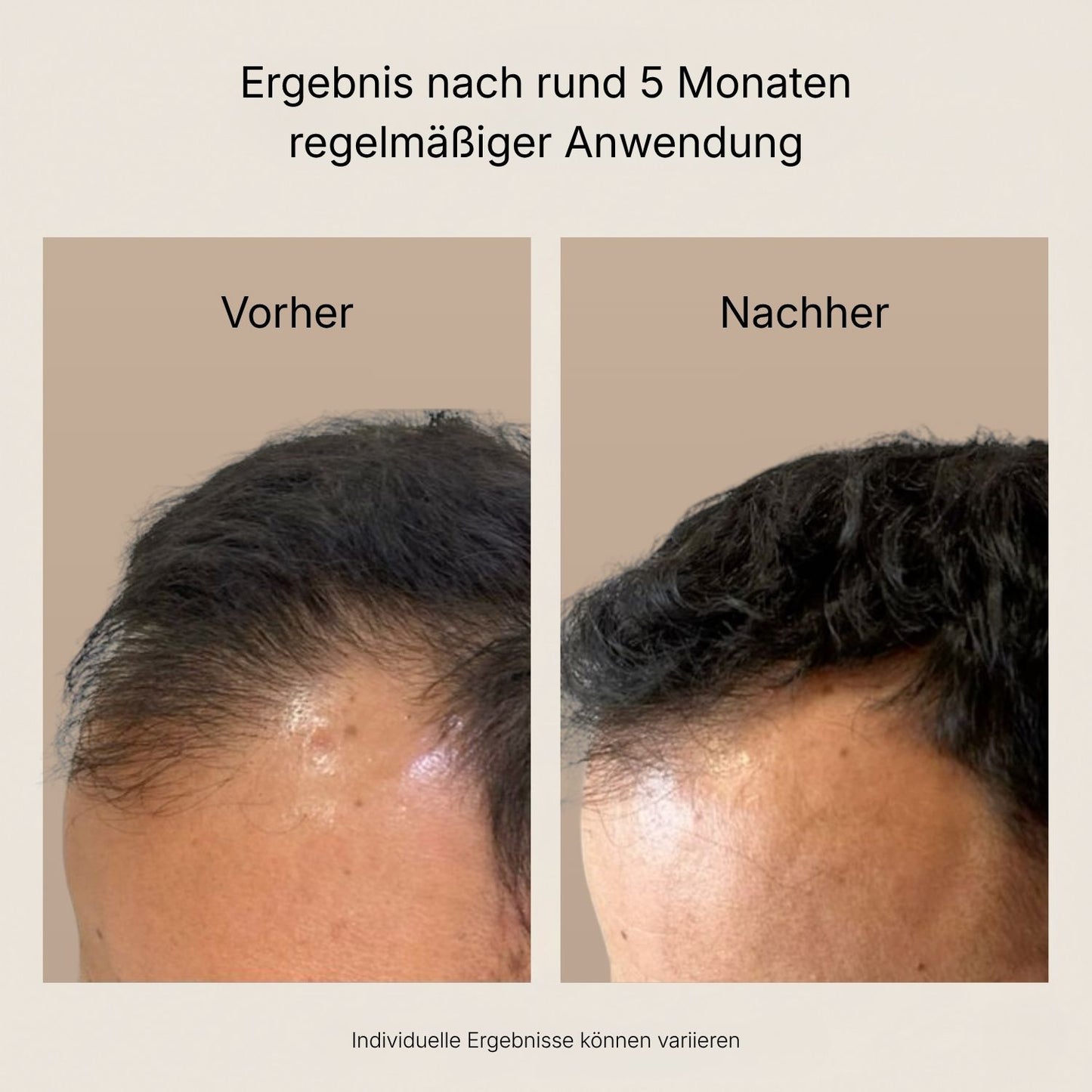 Die 90-Tage-Kur